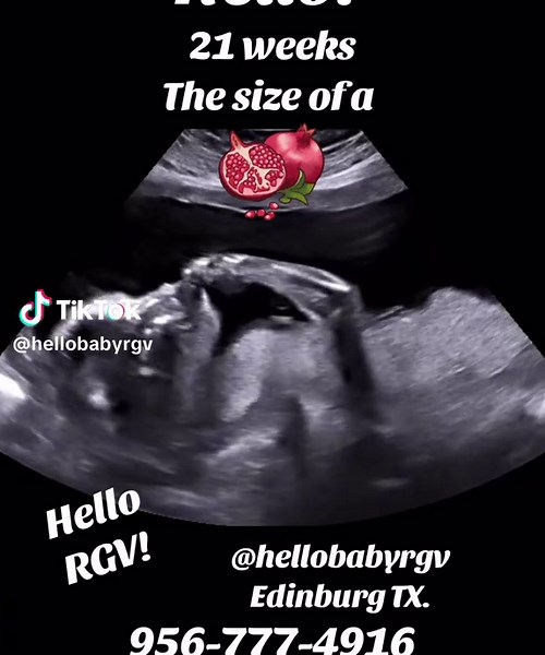 Weekend Appointment Availability for Ultrasounds