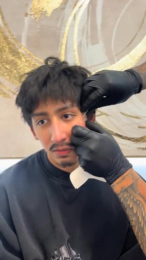 🤯Surface bar in the Face !! #surface #piercing #pierced #foryoupage #fypシ゚viral | Bear Reed Piercing