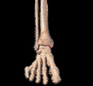 Distal Tibia Plating System