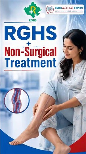 RGHS Beneficiaries के लिए खुशखबरी! Varicose Veins का बिना ऑपरेशन इलाज अब संभव