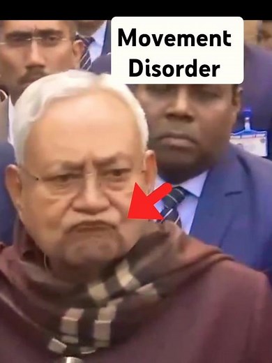 Tardive dyskinesia