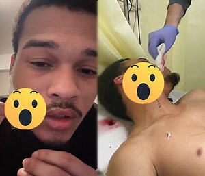 The Streets Ain’t Safe: Amazon Driver Gets Sliced In The Face In Random Attack While Delivering Packages In The Bronx!