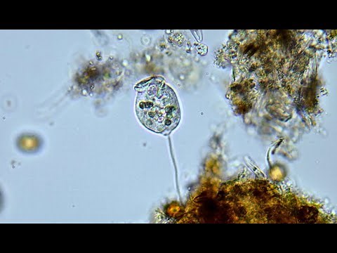 Microroganismos- Vorticella -