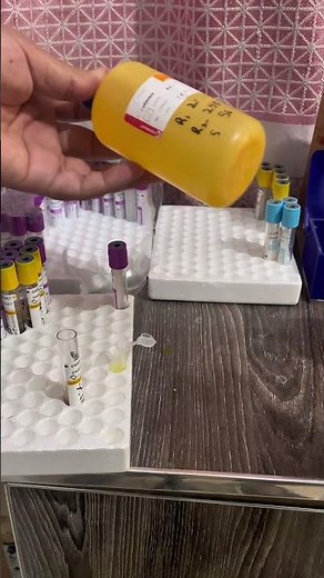 How to do serum Creatinine Test, step by step guide #creatinine #viralvideo #bloodgroup