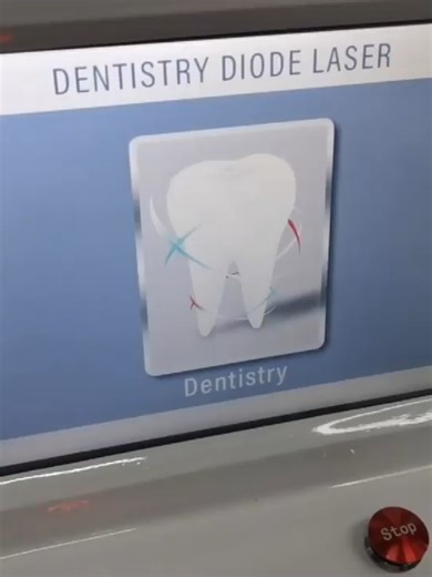 980nm Laser Machine #laser #980laser #teethcleaning #teethwhiteningsupplies #teethwhiteningstrips #beautymachine #diodelaser #AestheticMachine Welcome to inquiry whatsapp: https://api.whatsapp.com/send?phone=8617392599371 Wechat:17392599371 Telegram: 8617392599371 Instagram: 8617392599371 Email: augustine@ecoderm.cn