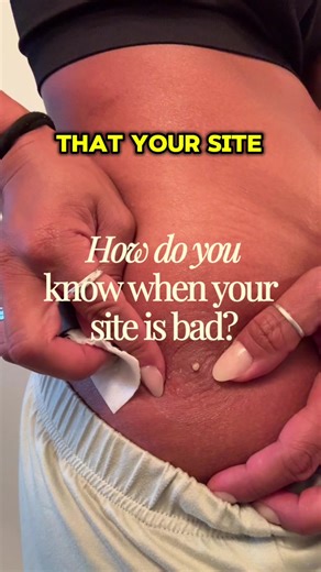 How do you know when your site is bad? Answered in this video! ##subcutaneousremodulin #remodulin #pulmonaryhypertension #pulmonaryarterialhypertension #rarediseases