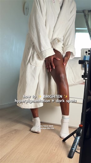 Effective Solutions for Hyperpigmentation and Body Acne