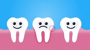 Toothache One Tooth Gets Hurt 4k Stock Footage Video (100% Royalty-free) 1069426687 | Shutterstock