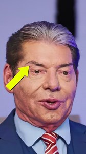 240K views · 1.6K reactions | What happened to Vince McMahon's face!?  #wrestling #wwe | Wrestlelamia.com | Facebook