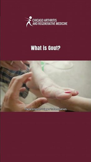 What is Gout? 🤔 Managing Gout Understanding causes, triggers, and effective treatments