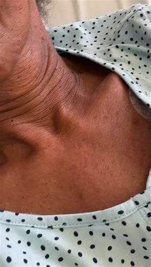 Nurse Otieno on TikTok