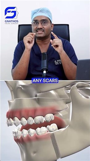 Chin Correction | What Are the Treatment Options? #shortsfeed #jawsurgery #cosmeticsurgery