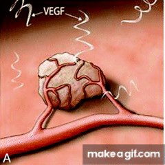 Mechanism of action of bevacizumab on Make a GIF