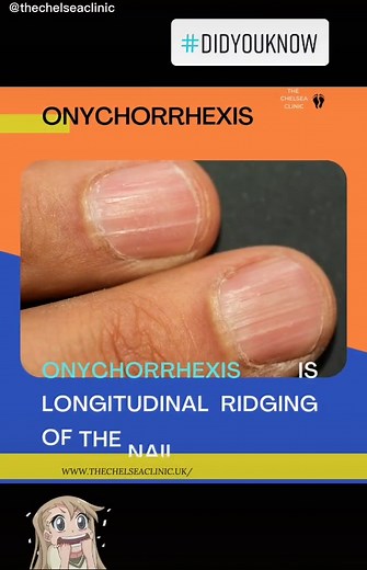 Understanding Onychorrhexis: Causes and Care for Nails