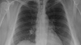 Share Your Science: The Impact of Deep Learning on Radiology | NVIDIA Technical Blog