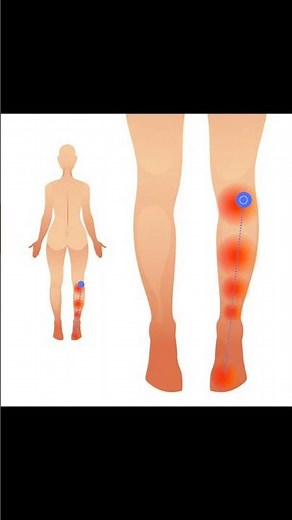 Plantaris Muscle Anatomy Explained 🦵#anatomy #meded #medicaleducation #podiatry #ATC #physio