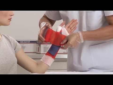 Delta-Cast Soft Short Arm Cast Application