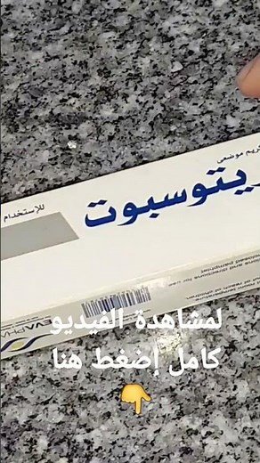My experience with Tretospot cream for scar removal and skin lightening