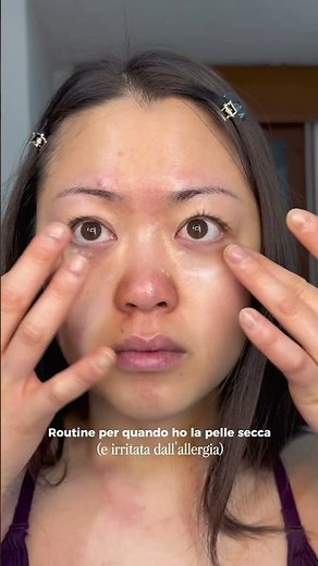 Skincare routine per pelle secca e irritata: