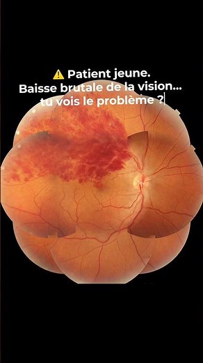 👁️ Cas clinique #7