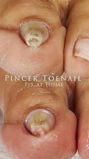 Are you tired of being told there is nothing that can be done? Learn how I've helped hundreds of thousands of people fix their nails. | The Meticulous Manicurist Nail Tutorials