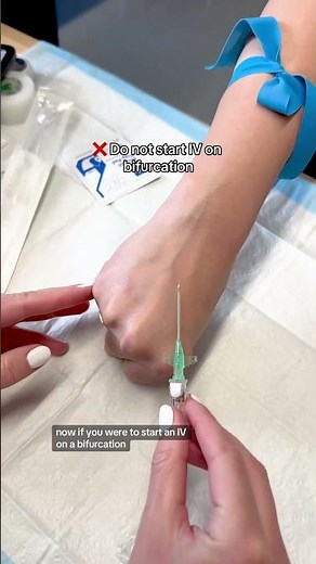 Bifurcation of the Vein