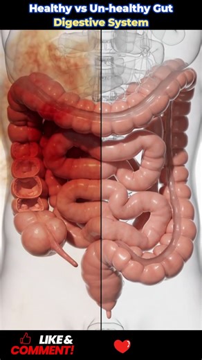 #DigestiveHealth #Constipation #GutHealth