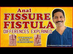 FISSURE vs FISTULA | Doctor Explains the Difference | Symptoms, Causes & Treatment | Dr.Peethambaran