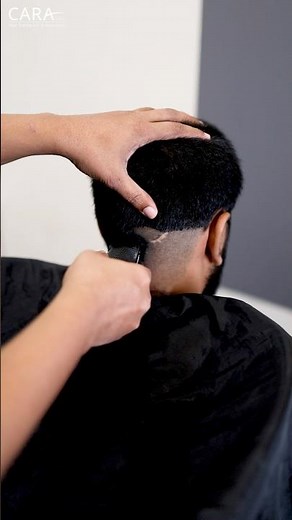 This Is How They Fix Your Hairline #hairtransplant #hairrestoration #procedure