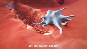 3D还原：身体的凝血过程