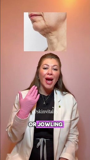 Platysma Band Treatment Explained | Botox for Neck Tightening & Jawline Definition