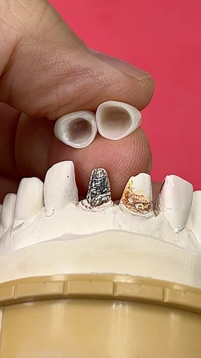 Hiding dark teeth colors! | CEO Luke Kahng