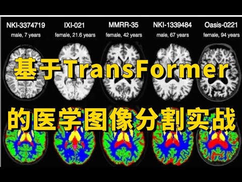 席卷CV界的Transformer到底有多牛！Swin-Unet：基于Transformer的医学图像分割实战，论文解读+源码复现 人工智能/机器学习/深度学习/神经网络/深度学习算法/深度学习入门