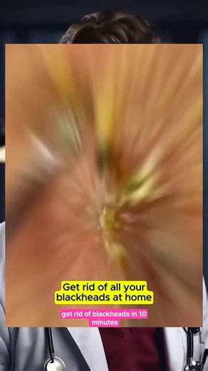 Healthy First on Instagram: "Natural recipe to get rid of all your blackheads at home #recipes"