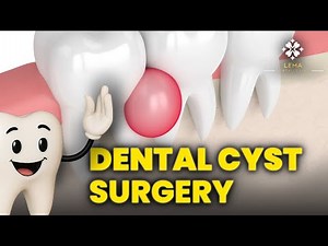 🤍 What is Dental Cyst Surgery? How is it Performed? - Lema Dental Clinic