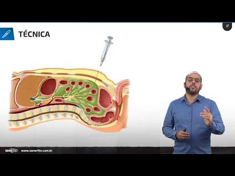 Paracentesis - SanarFlix Procedures Class