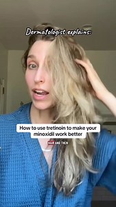 Sam Ellis, MD, FAAD | Dermatologist on Instagram: "Tretinoin 🤝 Minoxidil For anyone trying to maximize their hair growth journey, consider adding tretinoin to your routine! Apply to your scalp and follow with your minoxidil. Since tretinoin can be drying/irritating, I recommend starting just a couple nights a week and increasing as tolerated. I focus the application on my areas of least density. Follow for more hair growth tips 💕"