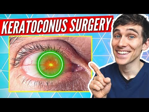 What is Corneal Collagen Crosslinking? Keratoconus Treatment Explained