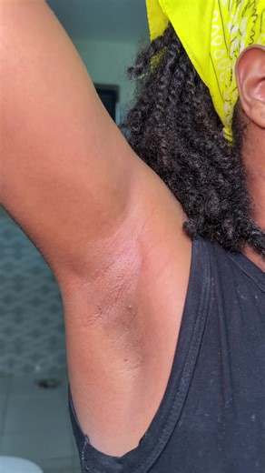 Understanding Sugar Waxing for Body Hair Care