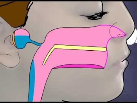 How to use the Otovent