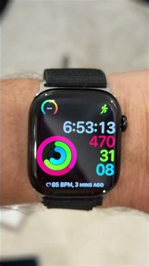 Apple Watch series 10 - what strap to buy?