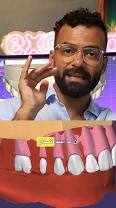 Important Role of of wax rim in Centric relation record on patient . . . . #exocad #exocadexpert #digitaldentures #smile #smiledesign #smilemakeover #veneers #veneer #molar #aethetic #emax #emaxpress #dentist #dentista #dentistry #dentalphotography #dentalcare #dentalclinic #dentalimplants #art | Mostafa Salah