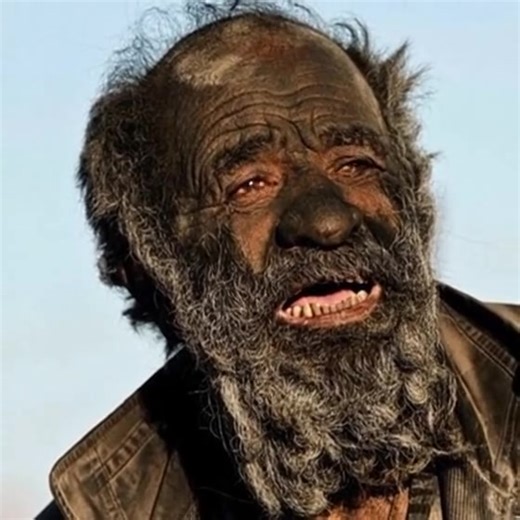 He became known as the “world’s dirtiest man” after going 67 years without a single bath… but when doctors finally examined him, the results left them completely STUNNED by what they discovered… 👇 | Dee Wallace