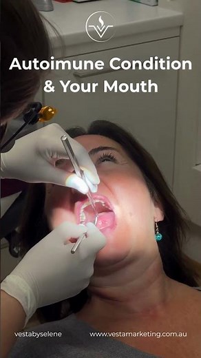 Autoimune Condition & Your Mouth