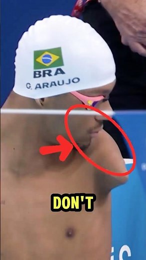 No Legs And No Arms From Brazil 🇧🇷