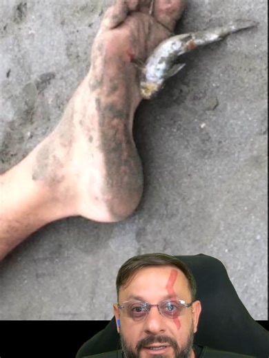 Cuidado com Bagres nas Praias