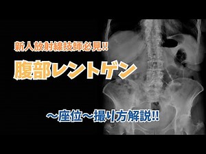 【新人放射線技師、医学生必見！】放射線技師による、レントゲンの撮りかた講座～腹部（part2）～