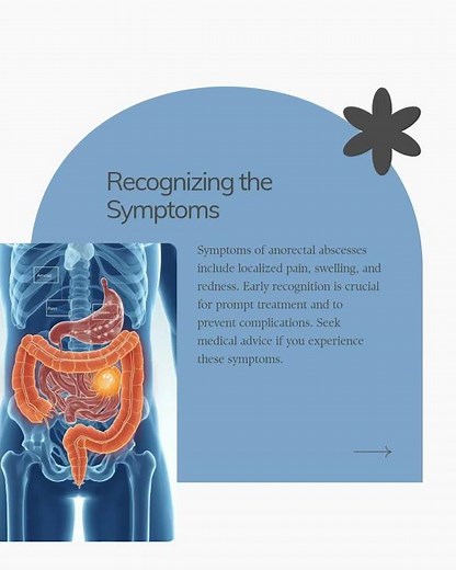 Anorectal Abscess – Don’t Ignore These Warning Signs!