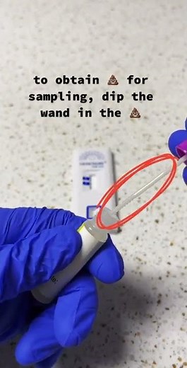 Fecal Occult Blood Test: How it’s done 💩