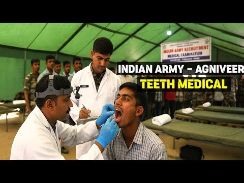Agniveer : Indian Army Teeth Medical Test | Dental Standards, Rejection Reasons & Complete Guide